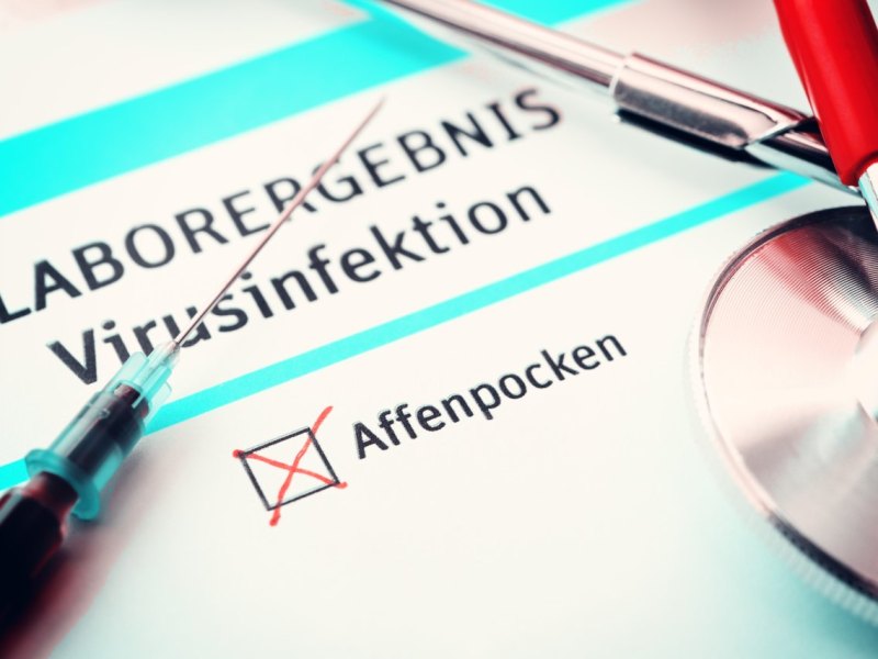 Affenpocken Kreis Peine.jpg
