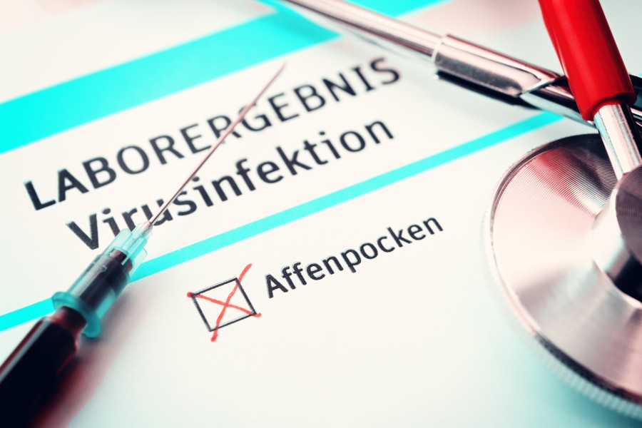 Affenpocken in Niedersachsen