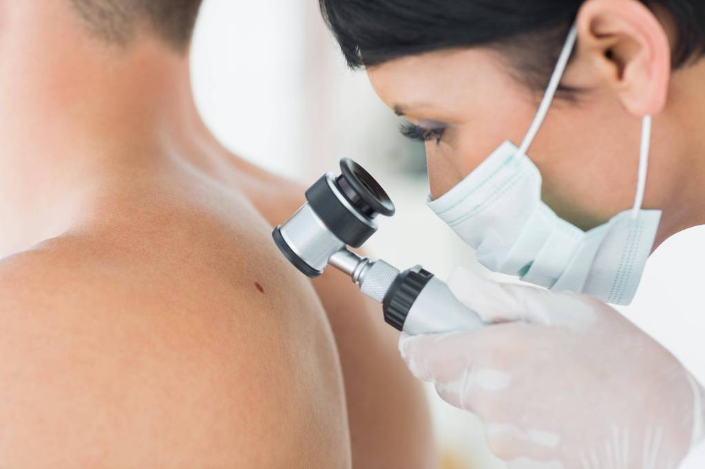 In den letzten Jahrzehnten haben sich die durch UV -Strahlung verursachten Hautkrebserkrankungsfälle stetig erhöht.