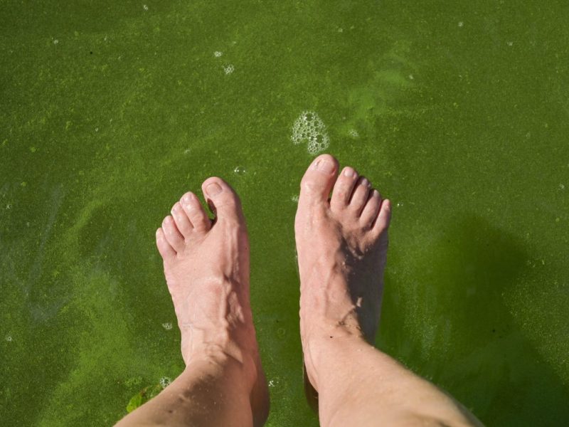 Alle Jahre wieder werden sie auch in Niedersachsen zur Plage: Blau-Algen. Die ersten Seen wurden ihretwegen schon gesperrt.